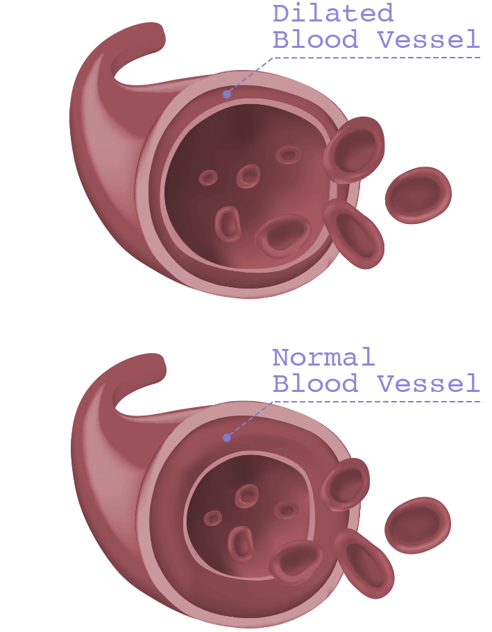 Therapeutic blood vessels diagram